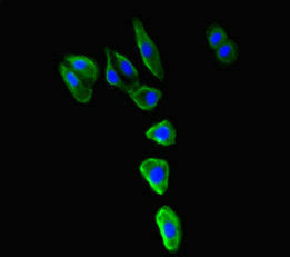 Mr1 Polyclonal Antibody - image 5