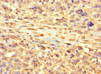 Western Blot; , Positive WB detected in: MCF-7 whole cell lysate; , All lanes: RSPH9 antibody at 1:2000; , Secondary; , Goat polyclonal to rabbit IgG at 1/50000 dilution; , Predicted band size: 32, 35 kDa; , Observed band size: 32 kDa;