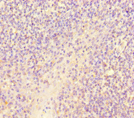 Immunohistochemistry of paraffin-embedded human thyroid tissue using CAC07677 at dilution of 1:100