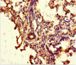 Immunofluorescent analysis of MCF-7 cells using CAC07680 at dilution of 1:100 and Alexa Fluor 488-congugated AffiniPure Goat Anti-Rabbit IgG(H+L)