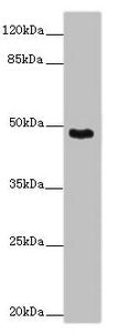 Immunohistochemistry of paraffin-embedded human colon cancer using CAC07681 at dilution of 1:100