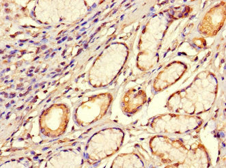 Immunofluorescent analysis of HepG2 cells using CAC07681 at dilution of 1:100 and Alexa Fluor 488-congugated AffiniPure Goat Anti-Rabbit IgG(H+L)