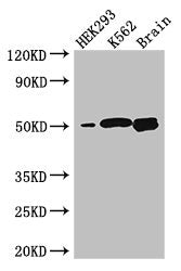 Immunohistochemistry of paraffin-embedded human testis tissue using CAC07683 at dilution of 1:100