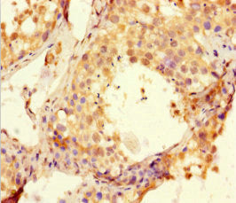 Immunohistochemistry of paraffin-embedded human pancreatic tissue using CAC07683 at dilution of 1:100