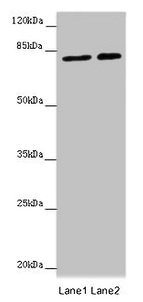 Immunohistochemistry of paraffin-embedded human breast cancer using CAC07685 at dilution of 1:100