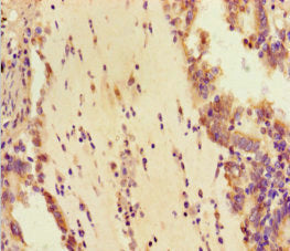 Immunofluorescent analysis of Hela cells using CAC07685 at dilution of 1:100 and Alexa Fluor 488-congugated AffiniPure Goat Anti-Rabbit IgG(H+L)