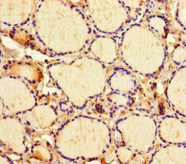 Immunohistochemistry of paraffin-embedded human adrenal gland tissue using CAC07690 at dilution of 1:100