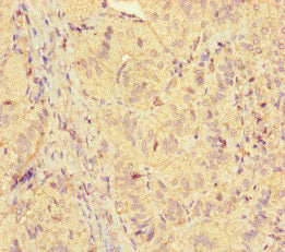 Western Blot; , Positive WB detected in: Mouse brain tissue; , All lanes: ICE1 antibody at 2.7µg/ml; , Secondary; , Goat polyclonal to rabbit IgG at 1/50000 dilution; , Predicted band size: 68 kDa; , Observed band size: 68 kDa;