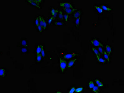 Western Blot; , Positive WB detected in: SH-SY5Y whole cell lysate, PC-3 whole cell lysate; , All lanes: ABLIM1 antibody at 1:2000; , Secondary; , Goat polyclonal to rabbit IgG at 1/50000 dilution; , Predicted band size: 88, 82, 49, 47, 53, 85 kDa; , Observed band size: 88, 53 kDa;