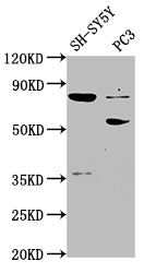 Ablim1 Polyclonal Antibody - image 5