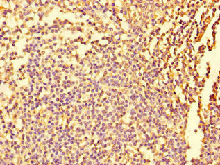 Immunofluorescent analysis of Hela cells using CAC07707 at dilution of 1:100 and Alexa Fluor 488-congugated AffiniPure Goat Anti-Rabbit IgG(H+L)