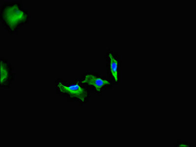 Western Blot; , Positive WB detected in: HepG2 whole cell lysate, Mouse brain tissue; , All lanes: FIGN antibody at 3µg/ml; , Secondary; , Goat polyclonal to rabbit IgG at 1/50000 dilution; , Predicted band size: 83 kDa; , Observed band size: 83, 38 kDa;
