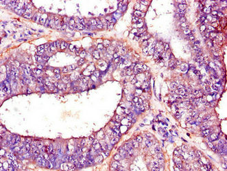 Immunofluorescent analysis of A549 cells using CAC07718 at dilution of 1:100 and Alexa Fluor 488-congugated AffiniPure Goat Anti-Rabbit IgG(H+L)