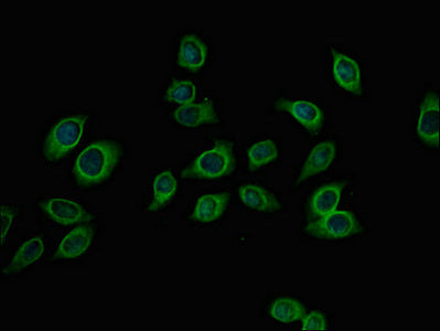 Pfkm Polyclonal Antibody - image 4
