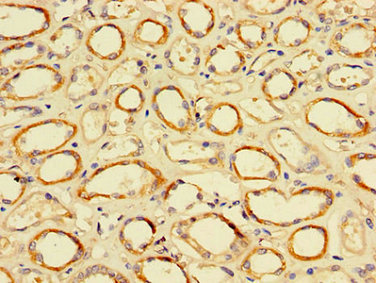 Tfdp2 Polyclonal Antibody - image 4