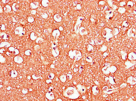Immunohistochemistry of paraffin-embedded human kidney tissue using CAC07757 at dilution of 1:100