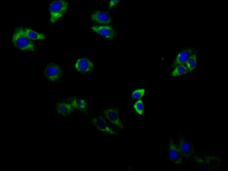 Adora2B Polyclonal Antibody - image 5