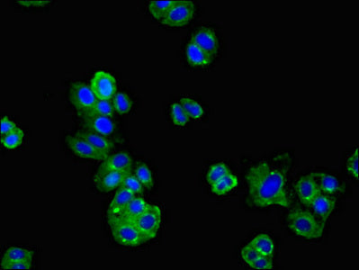 Agtr1 Polyclonal Antibody - image 4
