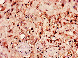 Hpse Polyclonal Antibody - image 3