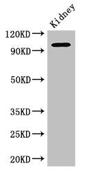Immunohistochemistry of paraffin-embedded human brain tissue using CAC07794 at dilution of 1:100