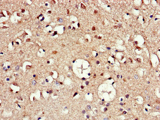 Immunofluorescent analysis of HepG2 cells using CAC07794 at dilution of 1:100 and Alexa Fluor 488-congugated AffiniPure Goat Anti-Rabbit IgG(H+L)