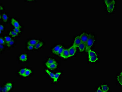 Aak1 Polyclonal Antibody - image 4