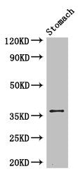 Immunohistochemistry of paraffin-embedded human brain tissue using CAC07797 at dilution of 1:100