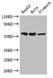 Immunohistochemistry of paraffin-embedded human small intestine tissue using CAC07800 at dilution of 1:100
