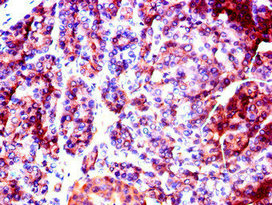 Immunofluorescent analysis of HepG2 cells using CAC07800 at dilution of 1:100 and Alexa Fluor 488-congugated AffiniPure Goat Anti-Rabbit IgG(H+L)
