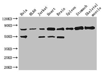 Immunohistochemistry of paraffin-embedded human colon cancer using CAC07809 at dilution of 1:100