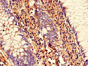 Immunofluorescent analysis of Hela cells using CAC07809 at dilution of 1:100 and Alexa Fluor 488-congugated AffiniPure Goat Anti-Rabbit IgG(H+L)