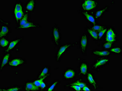 Senp1 Polyclonal Antibody - image 4