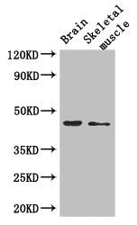 Immunohistochemistry of paraffin-embedded human colon cancer using CAC07810 at dilution of 1:100