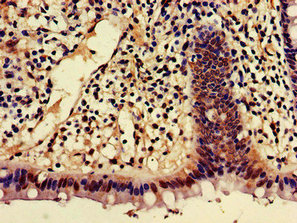 Ajap1 Polyclonal Antibody - image 3