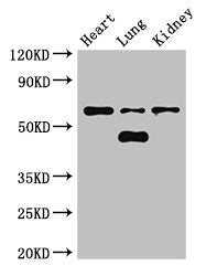 Immunohistochemistry of paraffin-embedded human colon cancer using CAC07817 at dilution of 1:100