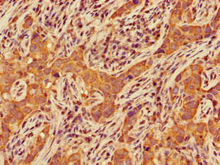 Immunofluorescent analysis of HepG2 cells using CAC07817 at dilution of 1:100 and Alexa Fluor 488-congugated AffiniPure Goat Anti-Rabbit IgG(H+L)