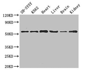 Immunohistochemistry of paraffin-embedded human small intestine tissue using CAC07832 at dilution of 1:100