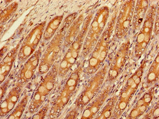 Immunohistochemistry of paraffin-embedded human kidney tissue using CAC07832 at dilution of 1:100