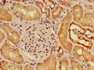 Immunofluorescent analysis of PC-3 cells using CAC07832 at dilution of 1:100 and Alexa Fluor 488-congugated AffiniPure Goat Anti-Rabbit IgG(H+L)
