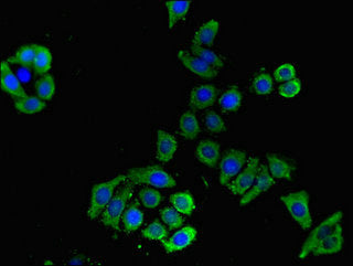 Slc16A9 Polyclonal Antibody - image 5