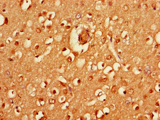 Immunofluorescent analysis of A549 cells using CAC07837 at dilution of 1:100 and Alexa Fluor 488-congugated AffiniPure Goat Anti-Rabbit IgG(H+L)