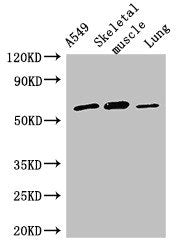 Immunohistochemistry of paraffin-embedded human pancreatic cancer using CAC07839 at dilution of 1:100