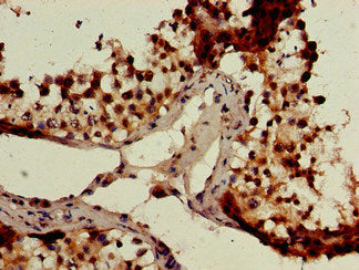Immunohistochemistry of paraffin-embedded human kidney tissue using CAC07859 at dilution of 1:100