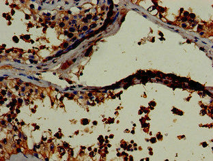Immunohistochemistry of paraffin-embedded human small intestine tissue using CAC07867 at dilution of 1:100