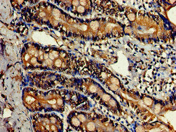 Immunofluorescent analysis of Hela cells using CAC07867 at dilution of 1:100 and Alexa Fluor 488-congugated AffiniPure Goat Anti-Rabbit IgG(H+L)