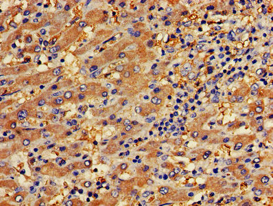 Immunofluorescent analysis of HepG2 cells using CAC07879 at dilution of 1:100 and Alexa Fluor 488-congugated AffiniPure Goat Anti-Rabbit IgG(H+L)