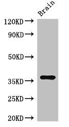Immunohistochemistry of paraffin-embedded human testis tissue using CAC07882 at dilution of 1:100