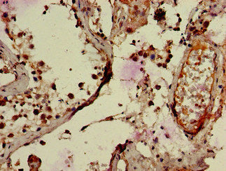 Immunohistochemistry of paraffin-embedded human pancreatic tissue using CAC07882 at dilution of 1:100