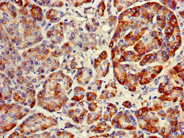 Immunofluorescent analysis of HepG2 cells using CAC07882 at dilution of 1:100 and Alexa Fluor 488-congugated AffiniPure Goat Anti-Rabbit IgG(H+L)