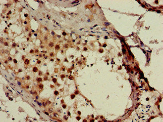 Immunofluorescent analysis of HepG2 cells using CAC07911 at dilution of 1:100 and Alexa Fluor 488-congugated AffiniPure Goat Anti-Rabbit IgG(H+L)